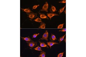 Immunofluorescence analysis of L929 cells using ZCCHC11 Rabbit pAb (ABIN6128939, ABIN6150406, ABIN6150407 and ABIN6221650) at dilution of 1:100. (ZCCHC11 Antikörper  (AA 1-290))