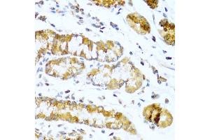 Immunohistochemistry of paraffin-embedded human stomach using GCG antibody (ABIN5970469) at dilution of 1/100 (40x lens). (Glucagon Antikörper)