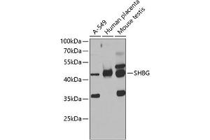 Western blot analysis of extracts of various cell lines, using SHBG antibody (ABIN6129327, ABIN6147736, ABIN6147737 and ABIN6223329) at 1:1000 dilution. (SHBG Antikörper  (AA 30-170))