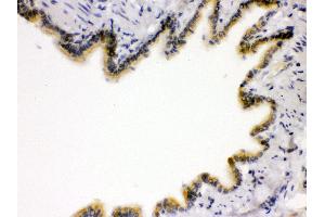 Anti- RAGE Picoband antibody, IHC(P) IHC(P): Rat Lung Tissue (RAGE Antikörper  (N-Term))