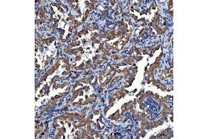 IHC analysis of SDF2L1 using anti-SDF2L1 antibody (ABIN7601111). (SDF2L1 Antikörper  (AA 29-221))