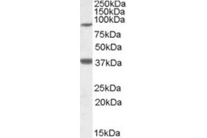 Western Blotting (WB) image for anti-Ceramide Synthase 1 (CERS1) (Internal Region) antibody (ABIN2466789) (LASS1 Antikörper  (Internal Region))