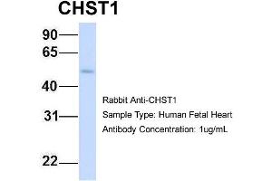 Host: Rabbit Target Name: CHST1 Sample Type: Human Fetal Heart Antibody Dilution: 1.