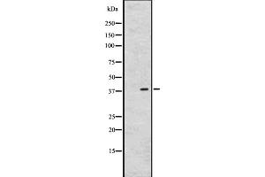 Western blot analysis of GPR26 expression in A431 whole cell lysate ,The lane on the left is treated with the antigen-specific peptide. (GPR26 Antikörper  (C-Term))