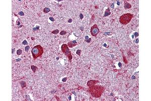 Immunohistochemistry (IHC) image for anti-Low Density Lipoprotein Receptor-Related Protein 8, Apolipoprotein E Receptor (LRP8) (AA 395-444) antibody (ABIN768922)