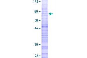 Image no. 1 for Calcitonin Receptor-Like (CALCRL) (AA 1-461) protein (GST tag) (ABIN1347880) (CALCRL Protein (AA 1-461) (GST tag))