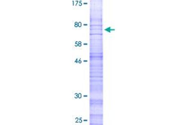 CALCRL Protein (AA 1-461) (GST tag)
