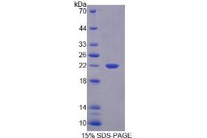 SDS-PAGE analysis of Mouse PLA2G12 Protein. (PLA2G12A Protein)