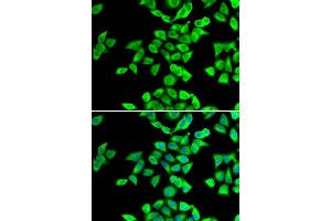Immunofluorescence analysis of U20S cell using NMT2 antibody. (NMT2 Antikörper)
