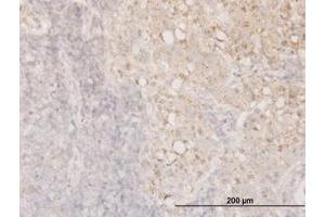 Image no. 3 for anti-Cofilin 1 (CFL1) (AA 1-167) antibody (ABIN598606) (Cofilin Antikörper  (AA 1-167))