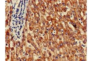 Immunohistochemistry of paraffin-embedded human liver tissue using ABIN7154260 at dilution of 1:100 (GRHPR Antikörper  (AA 1-328))
