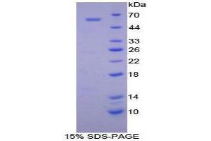 SDS-PAGE (SDS) image for Cadherin 4 (CDH4) (AA 667-916) protein (His tag,GST tag) (ABIN1877956)