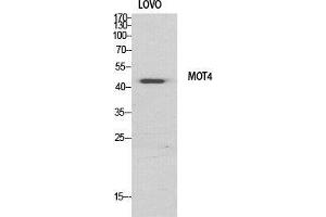Western Blotting (WB) image for anti-Solute Carrier Family 16 (Monocarboxylic Acid Transporters), Member 3 (SLC16A3) (Internal Region) antibody (ABIN6282238)