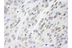 Immunohistochemistry (IHC) image for anti-Non-POU Domain Containing, Octamer-Binding (NONO) (AA 350-400) antibody (ABIN7448694) (NONO Antikörper  (AA 350-400))
