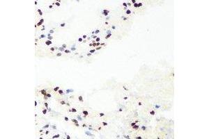 Immunohistochemical analysis of RNGTT staining in mouse lung formalin fixed paraffin embedded tissue section. (RNGTT Antikörper)