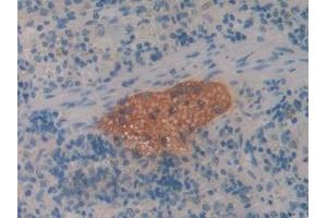 Immunohistochemistry (IHC) image for anti-serpin Peptidase Inhibitor, Clade A (Alpha-1 Antiproteinase, Antitrypsin), Member 6 (SERPINA6) (AA 267-390) antibody (ABIN7438400)