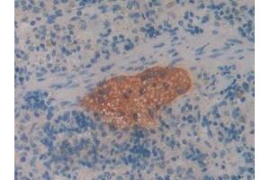 Detection of CBG in Rat Spleen Tissue using Polyclonal Antibody to Corticosteroid Binding Globulin (CBG) (SERPINA6 Antikörper  (AA 267-390))
