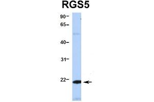 Hum. (RGS5 Antikörper  (Middle Region))