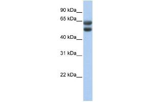 WB Suggested Anti-ZNF331 Antibody Titration:  0. (ZNF331 Antikörper  (N-Term))
