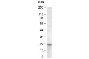 Western blot of A431 lysate with NRAS antibody at 0. (GTPase NRas Antikörper)