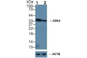 Knockout Varification: ;Lane 1: Wild-type Hela cell lysate; ;Lane 2: CDK4 knockout Hela cell lysate; ;Predicted MW: 33kDa ;Observed MW: 33kDa;Primary Ab: 1µg/ml Rabbit Anti-Human CDK4 Ab;Second Ab: 0. (CDK4 Antikörper  (AA 6-295))