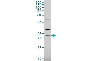 RGS5 polyclonal antibody (A01), Lot # 060608JCS1 Western Blot analysis of RGS5 expression in K-562 . (RGS5 Antikörper  (AA 94-181))