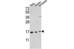 Western blot analysis of PPIA Antibody (PPIA Antikörper  (N-Term))