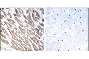 Immunohistochemistry analysis of paraffin-embedded human heart tissue, using F13B Antibody. (F13B Antikörper  (AA 61-110))