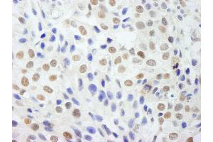 Immunohistochemistry (IHC) image for anti-DEAD (Asp-Glu-Ala-Asp) Box Polypeptide 54 (DDX54) (AA 625-675) antibody (ABIN7448523) (DDX54 Antikörper  (AA 625-675))