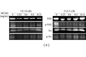 Western Blotting (WB) image for anti-PTK2 Protein tyrosine Kinase 2 (PTK2) (C-Term) antibody (ABIN2854860)