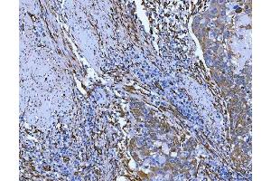 IHC analysis of Hsp47/SERPINH1 using anti-Hsp47/SERPINH1 antibody (ABIN3043331).