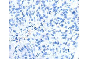 Immunohistochemistry (IHC) image for anti-Glutamate Receptor, Metabotropic 8 (GRM8) antibody (ABIN1872903) (GRM8 Antikörper)