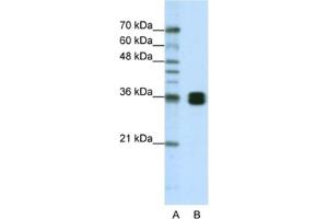 Western Blotting (WB) image for anti-Heterogeneous Nuclear Ribonucleoprotein A0 (HNRNPA0) antibody (ABIN2462229)