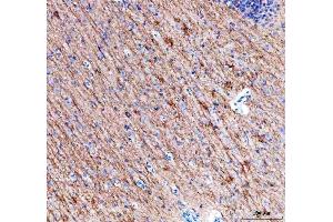 IHC analysis of Alpha Internexin using anti-Alpha Internexin antibody (ABIN4886634). (INA Antikörper  (AA 71-161))