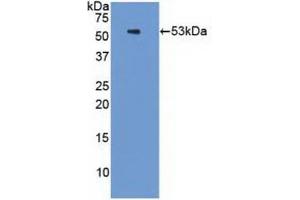 Detection of Recombinant PSMC3, Human using Polyclonal Antibody to Proteasome 26S Subunit, ATPase 3 (PSMC3) (PSMC3 Antikörper  (AA 2-439))
