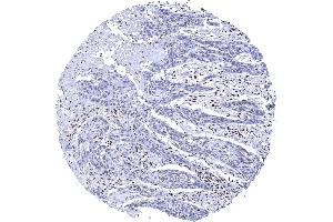 Immunohistochemistry (IHC) image for anti-X-Ray Repair Complementing Defective Repair in Chinese Hamster Cells 5 (Double-Strand-Break Rejoining) (XRCC5) antibody (ABIN7477623)