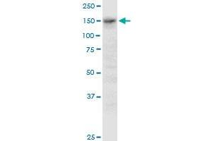 ADAMTS3 monoclonal antibody (M08A), clone 1D6. (ADAMTS3 Antikörper  (AA 1048-1128))