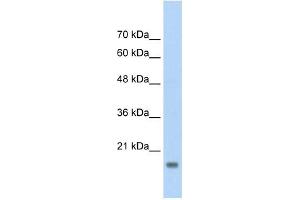 AMFR antibody used at 2. (AMFR Antikörper  (C-Term))