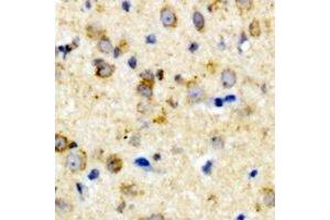 Immunohistochemical analysis of CALHM1 staining in rat brain formalin fixed paraffin embedded tissue section. (CALHM1 Antikörper)