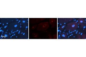 Immunohistochemistry (IHC) image for anti-D4, Zinc and Double PHD Fingers, Family 3 (DPF3) (N-Term) antibody (ABIN2775709)