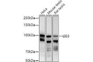 Western blot analysis of extracts of various cell lines, using (ABIN6130288, ABIN6143207, ABIN6143208 and ABIN6217532) at 1:1000 dilution. (LIG3 Antikörper  (AA 730-1009))