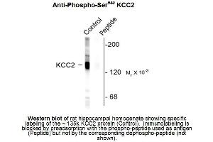 Western Blotting (WB) image for anti-Solute Carrier Family 12 (Potassium-Chloride Transporter) Member 5 (SLC12A5) (pSer940) antibody (ABIN6658257)