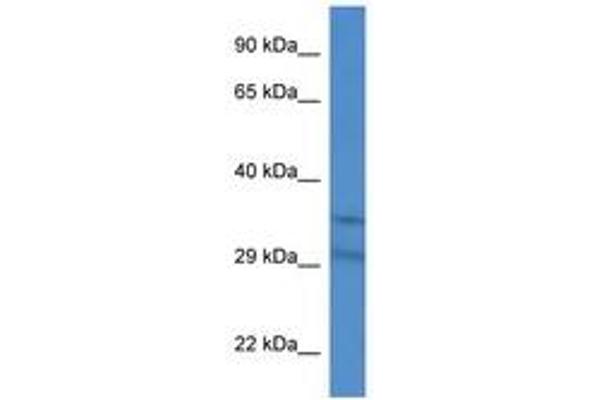 SLC25A31 antibody  (AA 150-199)