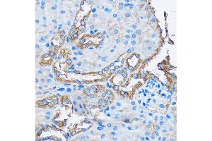 Immunohistochemistry of paraffin-embedded Mouse kidney using C Rabbit pAb (ABIN3022800, ABIN3022801, ABIN3022802 and ABIN6219234) at dilution of 1:50 (40x lens). (CAPZA2 Antikörper  (AA 1-286))