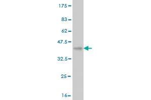 Western Blot detection against Immunogen (36. (VPS18 Antikörper  (AA 3-100))