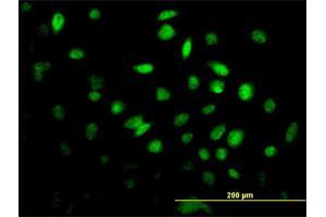 Immunofluorescence of monoclonal antibody to FOXF2 on HeLa cell. (FOXF2 Antikörper  (AA 346-443))