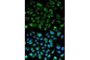 Immunofluorescence analysis of HeLa cell using PRKAR1A antibody. (PRKAR1A Antikörper  (AA 1-250))