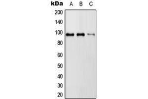 Western blot analysis of RASA3 expression in HeLa (A), SP2/0 (B), H9C2 (C) whole cell lysates.