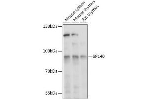 Western blot analysis of extracts of various cell lines, using SP140 antibody (ABIN7270507) at 1:1000 dilution. (SP140 Antikörper  (AA 1-180))