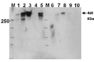 Western blot using PRKDC (phospho T2609) polyclonal antibody  shows detection of a 460 KDa band corresponding to human PRKDC in various preparations. (PRKDC Antikörper  (pThr2609))
